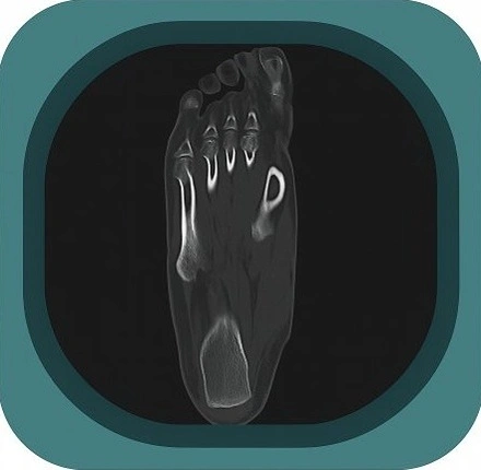 CT foot anatomy icon